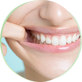 セルフホワイトニング